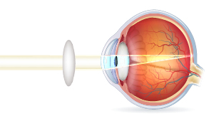 Korrigeret langsynethed